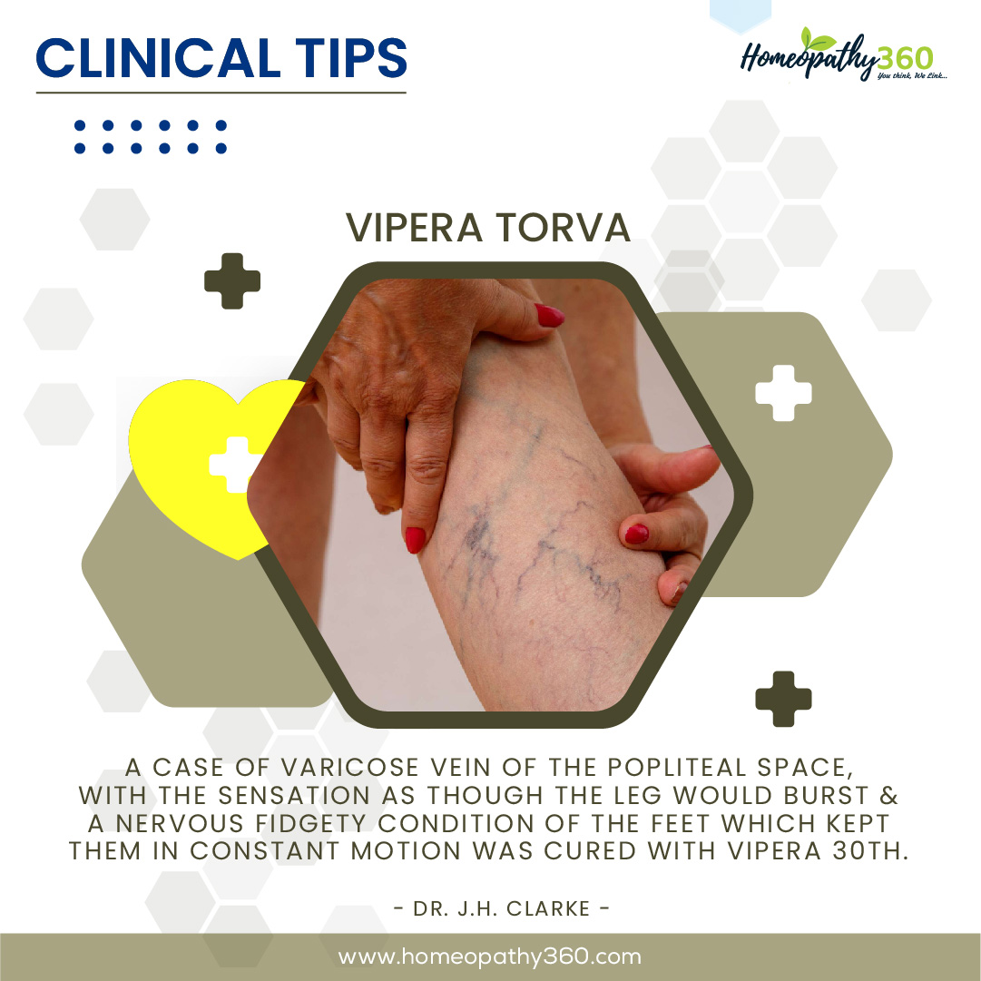 Vipera Torva: Clinical Tips by Dr. J.H. Clarke