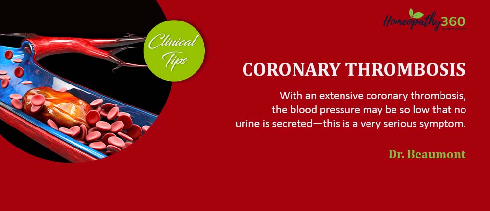 Coronary Thrombosis: Dr. Beaumont