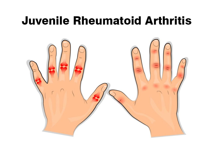 Best Article For Homeopathic Doctor Homeopathy 360 Part 2