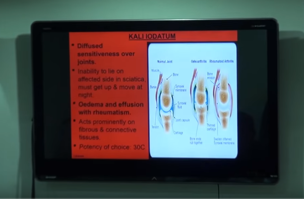Kali Iod An Excellent Joint Remedy By Dr Saptarshi Banerjea Homeopathy360