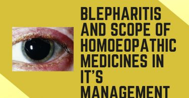 Blepharitis And Scope Of Homoeopathic Medicines In It’s Management
