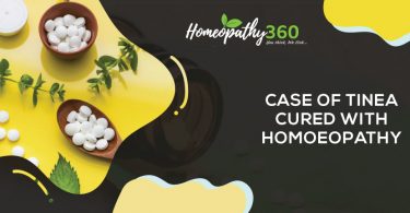 Case of Tinea Cured With Homoeopathy