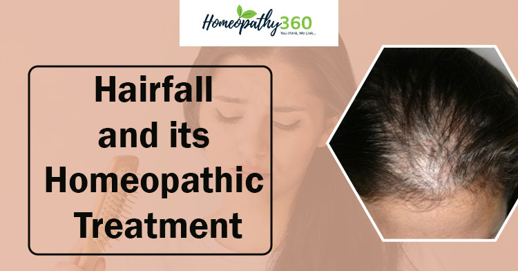 Hair Fall or Hair Loss Causes, Symptoms and Treatment with Homeopathic  Medicine - homeopathy360