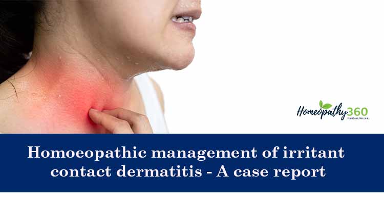 irritant contact dermatitis