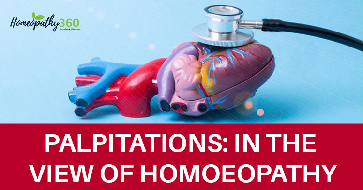 Palpitations: In the View of Homoeopathy