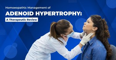 Homoeopathic Management of Adenoid Hypertrophy: A Therapeutic Review