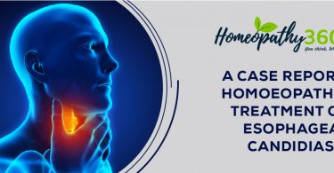 Oesophageal Candidiasis
