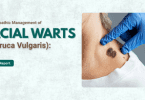 Facial Warts