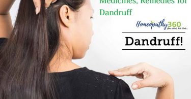 Homeopathic Treatment, Medicines, Remedies for Dandruff