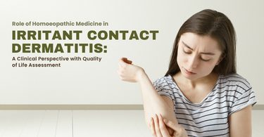Role of Homoeopathic Medicine in Irritant Contact Dermatitis