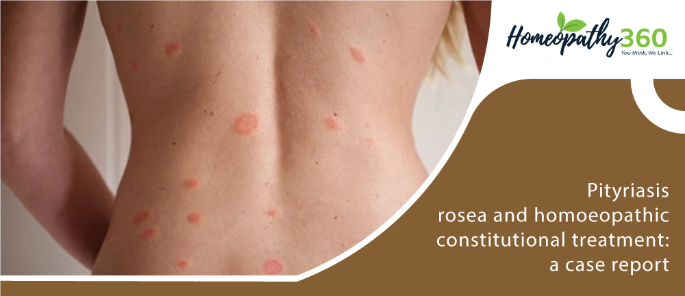 Pityriasis Rosea Prognosis Pityriasis Rosea Rash Symptoms Causes