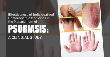 Effectiveness of Individualized Homoeopathic Medicines in the Management of Psoriasis