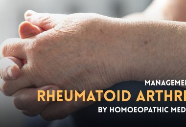 RHEUMATOID ARTHRITIS