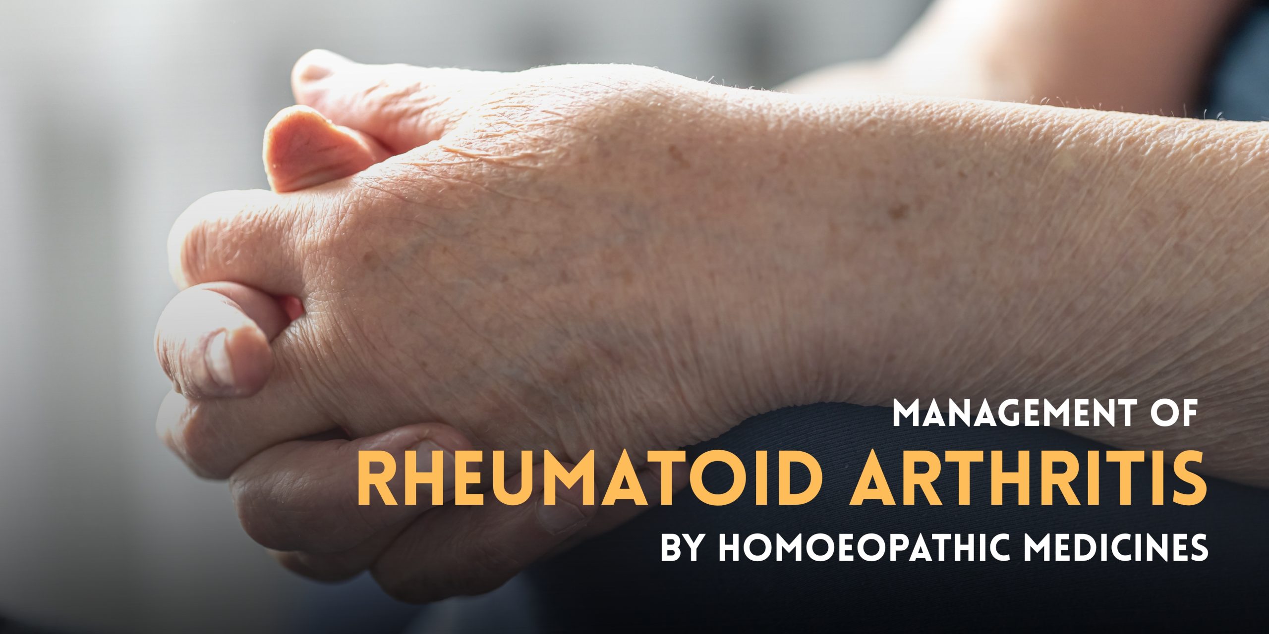 Management of Rheumatoid Arthritis By Homoeopathic Medicines