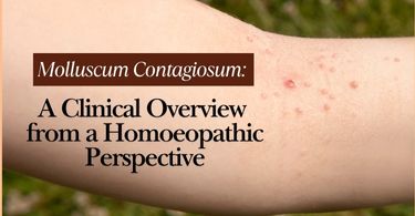 thumbnail-a clinical overview