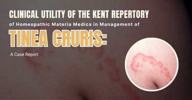 Clinical Utility of the Kent Repertory of Homeopathic Materia Medica in Management of Tinea Cruris