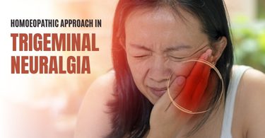 Trigeminal Neuralgia