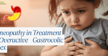Homeopathy in Treatment of Overactive Gastrocolic Reflex