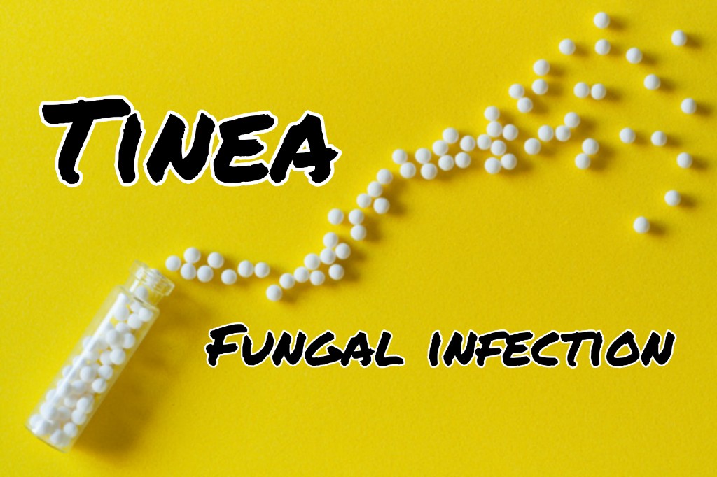 Tinea Cruris Tinea Infection Treatment Types Of Tinea